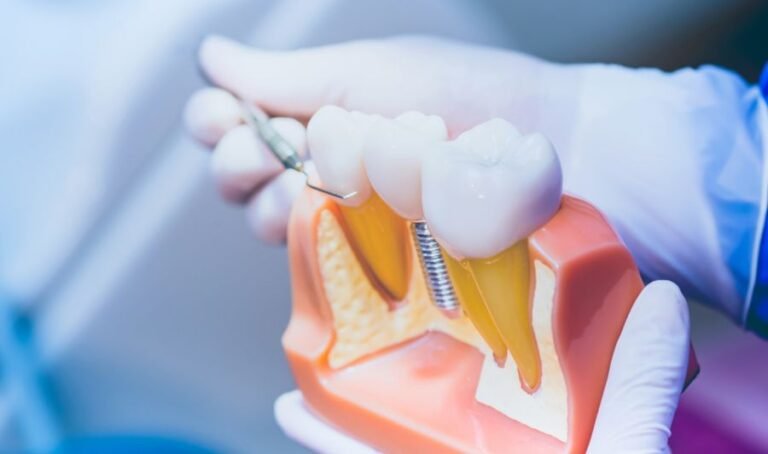 Dental Treatment Abroad Helvetic Clinics